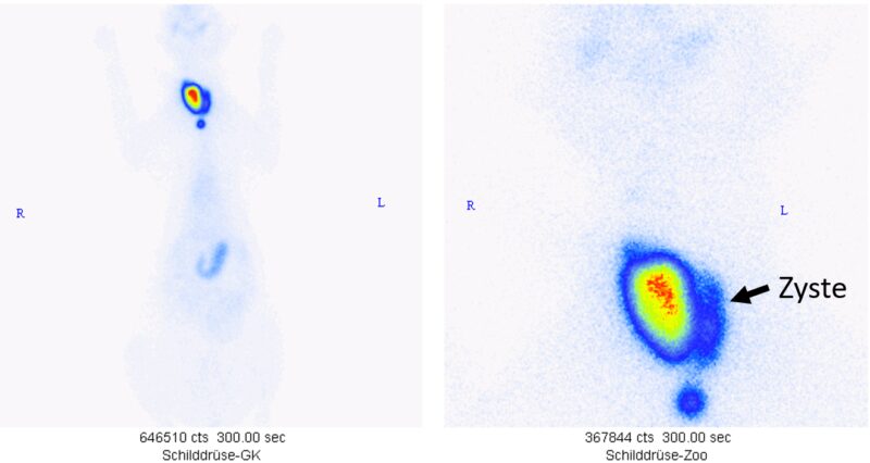 Abb3 zystische Zubilding SD