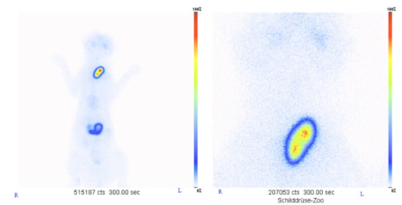 Abb5 hpothreose heisser Knoten