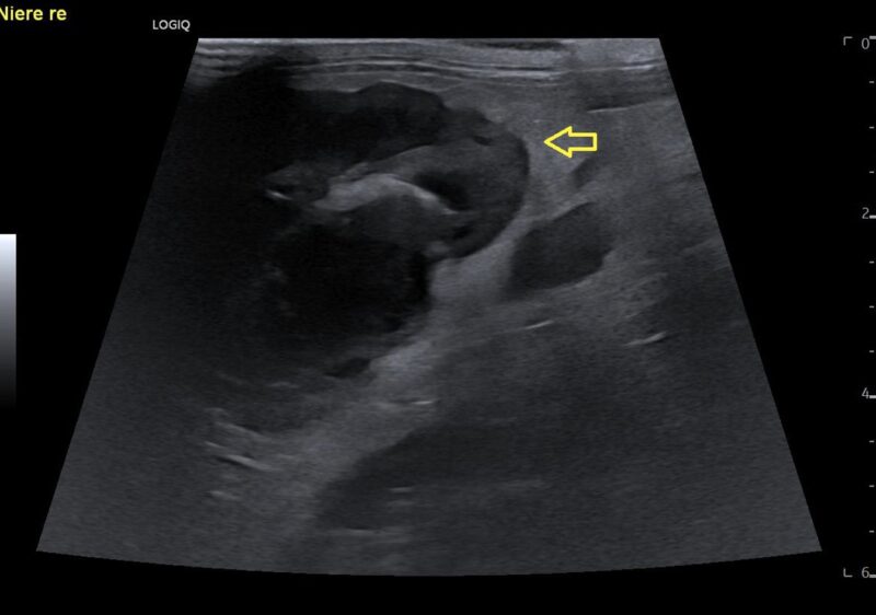 Bildschirmfoto 2026 03 15 um 17 09 18