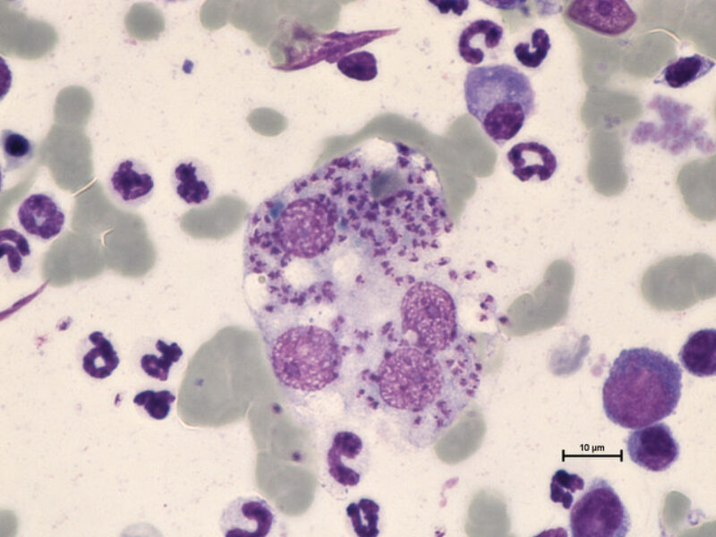 Leishmania infantum im Knochenmark 2