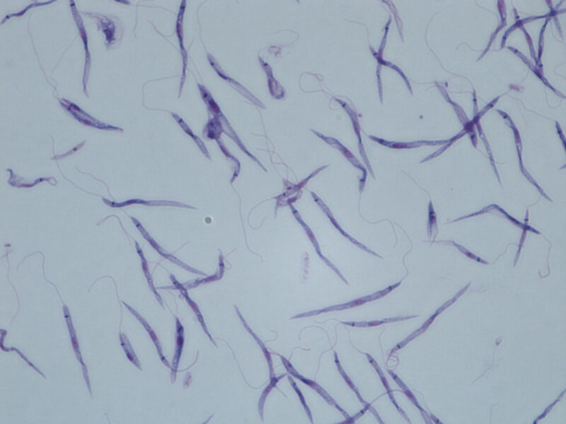 Leishmania infantum Giemsa gefarbt
