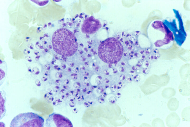 Leishmania infantum im Knochenmark