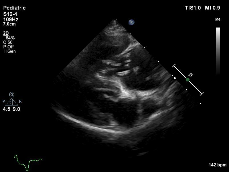 JAN18 PRAE WORMS RVRA 2
