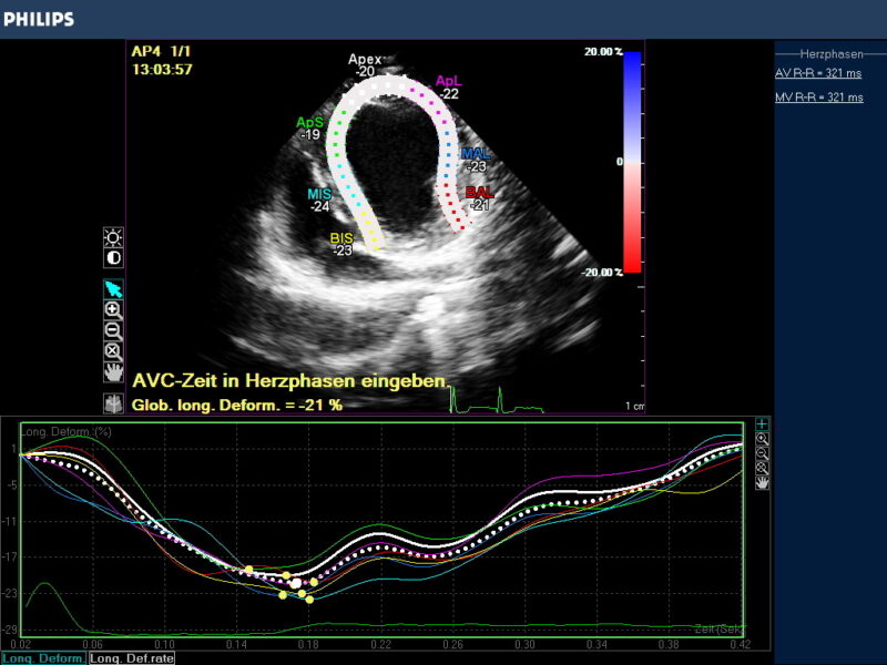 Abb 2 Boxer normale Strain 21