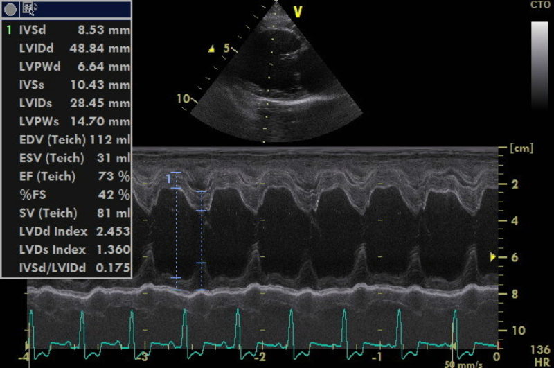 Alf Jene 2016 01 26 Echo1  Lv