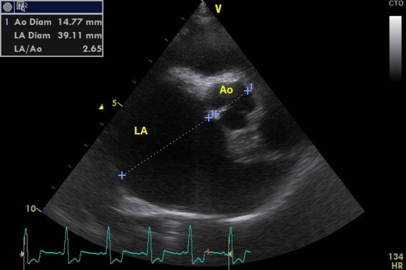 Alf Jene 2016 01 26 Echo2 Laao