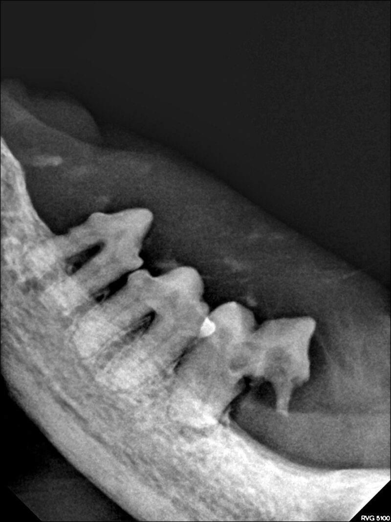 Hochgradige Entzuendung mit Roentgenbefund 2