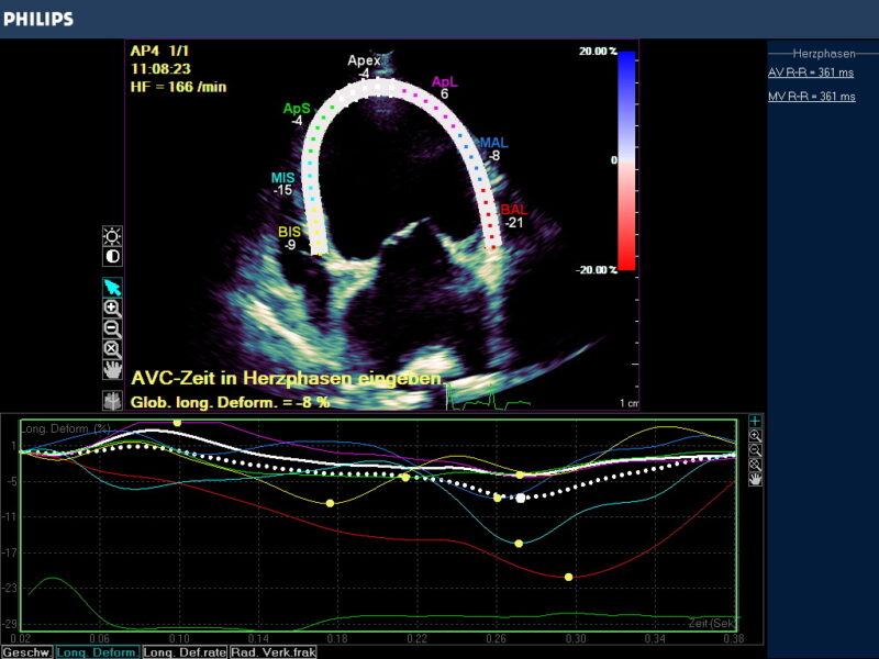 Speckle Abb 5 BERNHARDINER