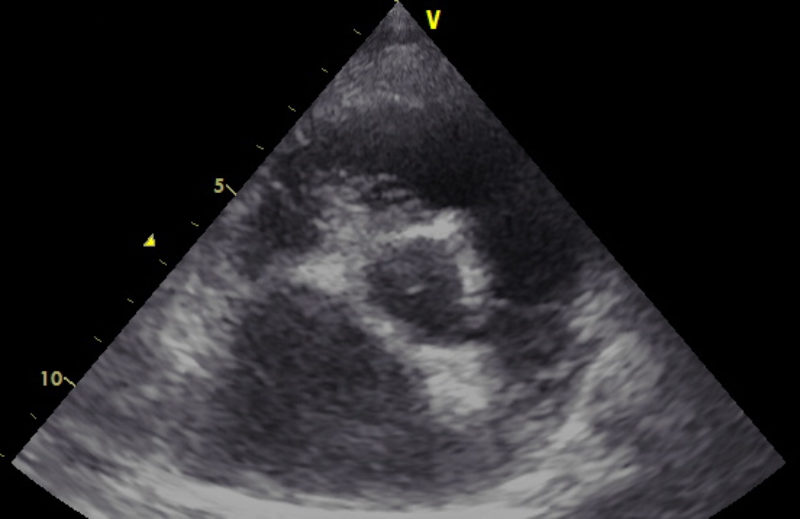 Stock3A 2 D Kurzachse La Ao