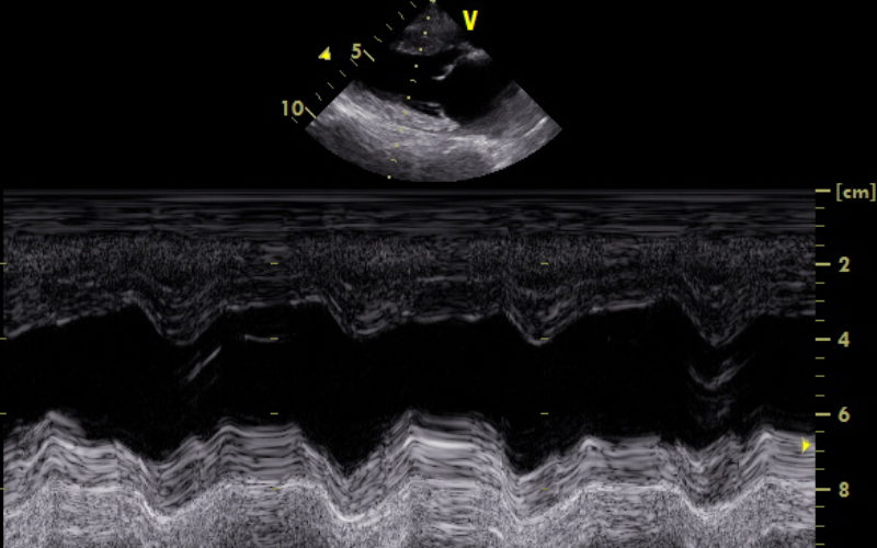 Stock5 M Mode Sinusrythmus