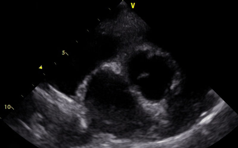 Stock5A 2 D Kurzachse La Ao