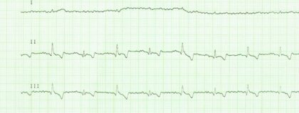 W584 Herzrhythmusstoerungen beim Kleintier 1