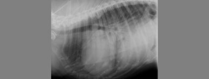 Systolische dysfunktion